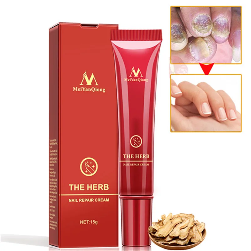 

Natural Herb Nail Treatments Cream Nail Foot Protector Skin Care Cream Nail Fungus Treatment Herb Nails Repair Cream
