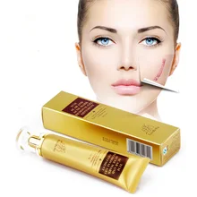 Крем для удаления шрамов от акне, крем для восстановления кожи, крем для лица от акне и пятен, лечение угрей, отбеливающий крем США, Прямая поставка