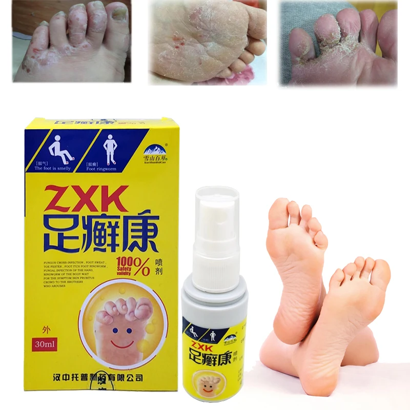 Foot & Shoe Deodorant Spray Feet Care Anti Itch Sweat Odor Feet