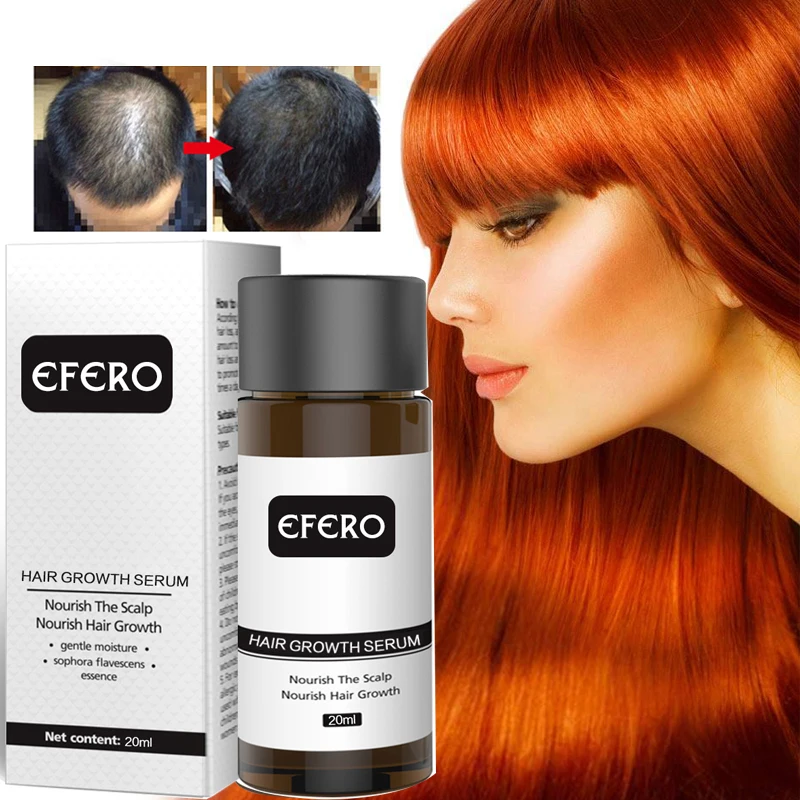 EFERO мощная эссенция для роста волос продукты для выпадения волос эфирное масло лечение облысения Предотвращение выпадения волос уход за волосами рост 20 мл
