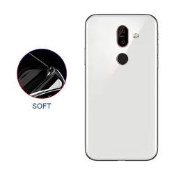 На Алиэкспресс купить чехол для смартфона mobile phone shell anti-fall personality transparent all-inclusive protective shell for nokia 7.1 plus