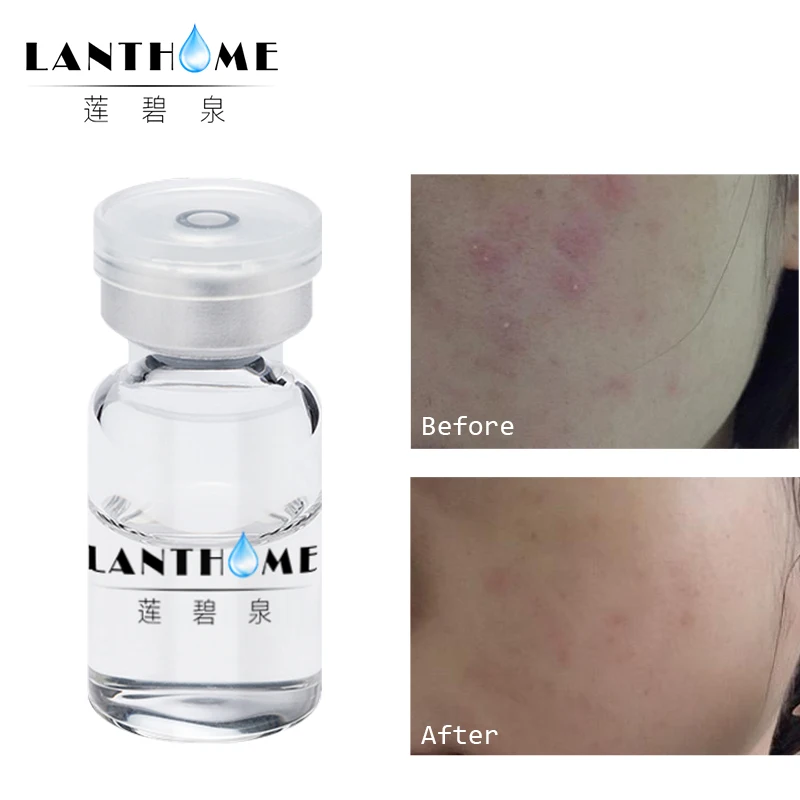 Powerful Anti Aging Anti Wrinkle Whitening Facial Serum Hyaluronic Acid Skin Six Peptides Hydrolyzed Collagen Serum