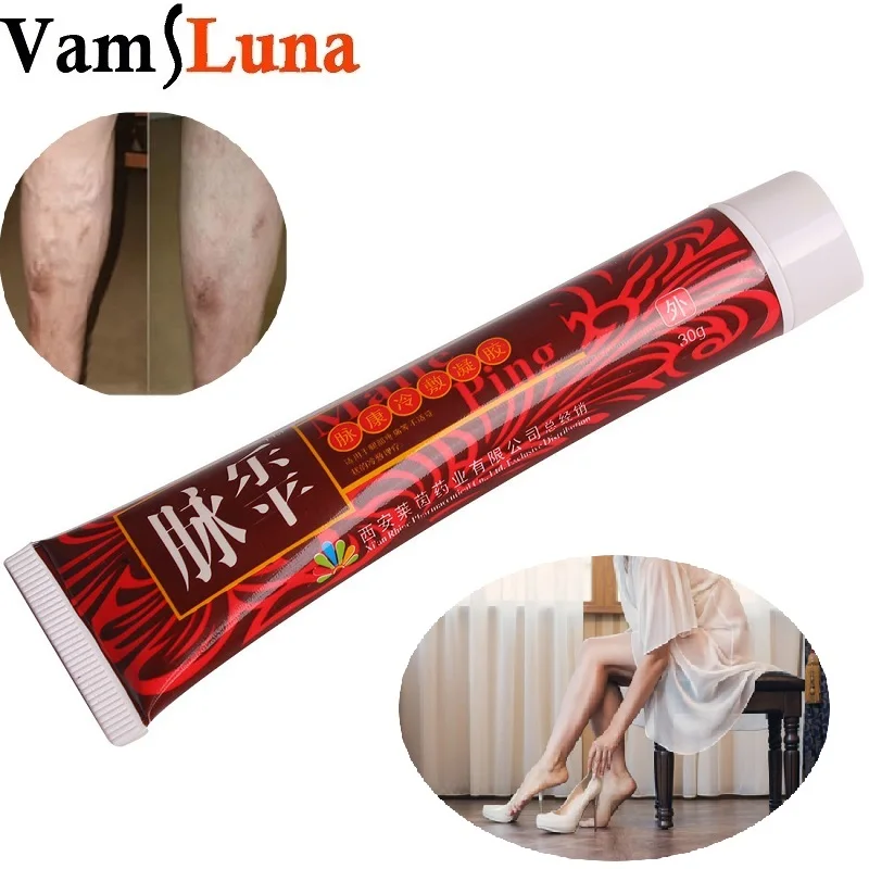 

10X Varicose Veins Treatment Cream Ointment Vasculitis Phlebitis Spider Veins Pain Varicosity Angiitis Remedy Removal No Surgery