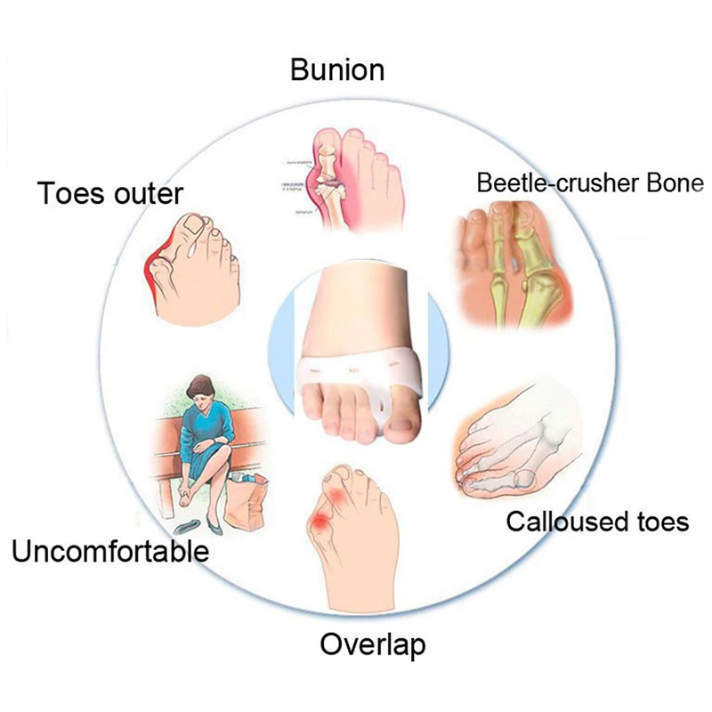 1 пара силиконовых гелевых разделителей для пальцев ног, защита от вальгусной деформации большого пальца, регулятор вальгусной деформации, инструмент для ухода за ногами L0037