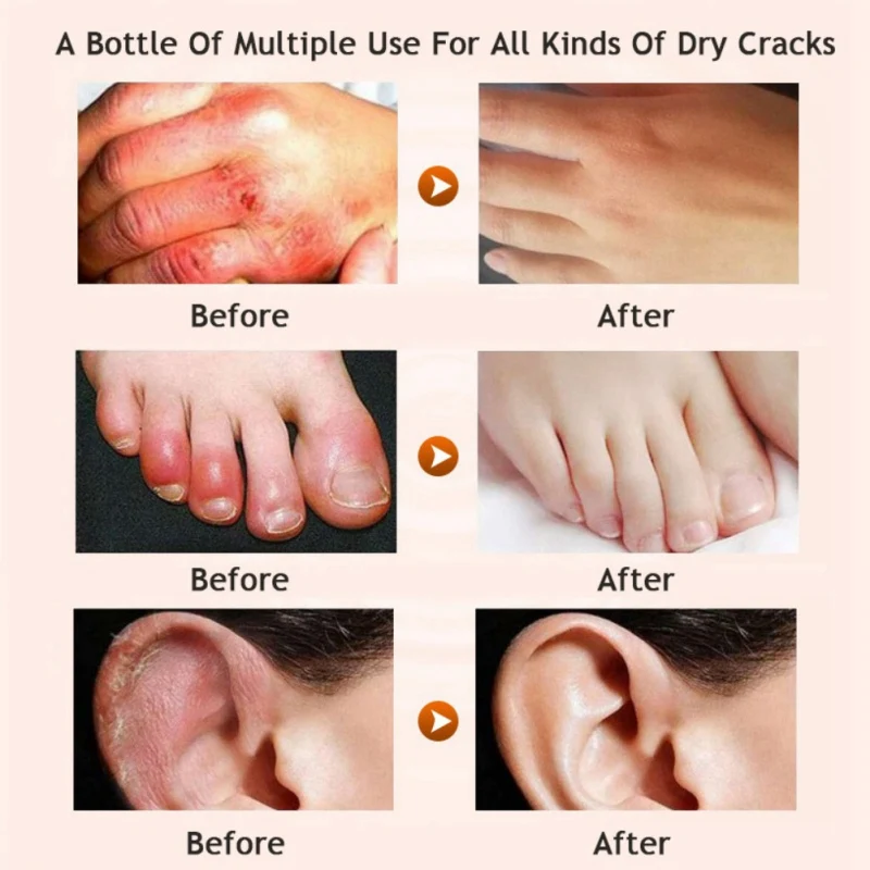Новый пилинг стопы рука ремонт против сухой Crack мазь крем 20 г восстановления кожи медовый увлажняющий уход за кожей ног крем