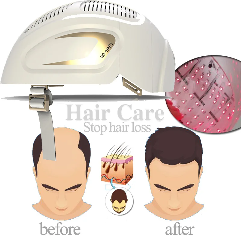 

Professional hair loss growth Laser Helmet Medical Diodes Treatment Hair Loss Solution Hair Fast Regrowth LLLT Laser Cap