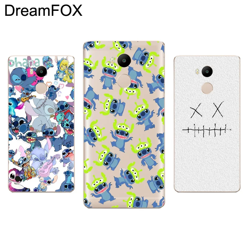 DREAMFOX M355 Stitch Soft TPU Silicone Case Cover For Xiaomi Redmi Note 3 4 5 Plus 3S 4A 4X 5A Pro Global |