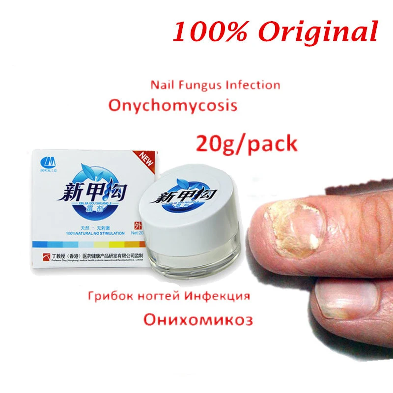 Chinese Medicine Herbs Toe Nail Fungus Treatment Anti Fungal Nail