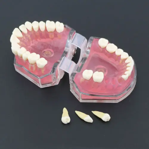 dental com dentes modelo padrão removíveis 4004 01 estudo dental ensine teeth modelo 9 Modelo de Ensino Dental