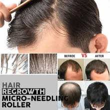 Регровт волос микро-needling ролик бороды продукт роста продукты против выпадения волос волосы гуще и полнее ускорение роста волос