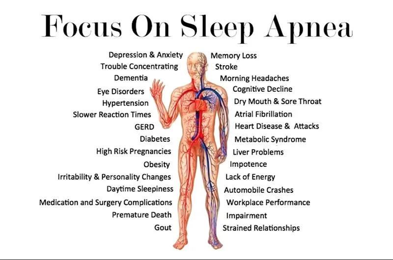 Аккумуляторный вентилятор дезинфицирующее средство сипап apap Авто CPAP BPAP дезинфектор апноэ сна OSAS анти храп 2000mAh