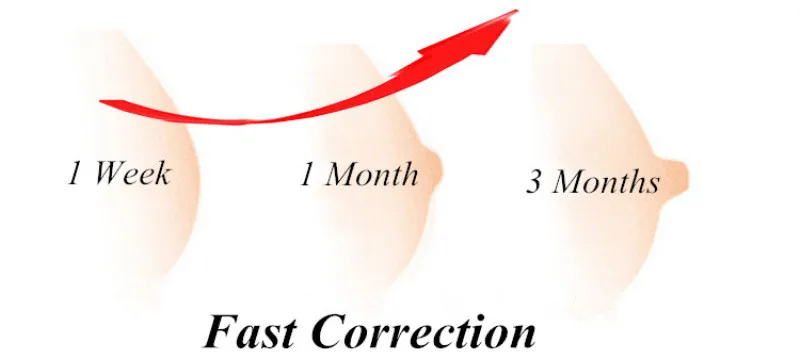 Аспиратор для сосков, съемник для лечения перевернутых сосков, корректор, зажим для плоских ниплет, коррекция коррекции, корректор для грудного вскармливания