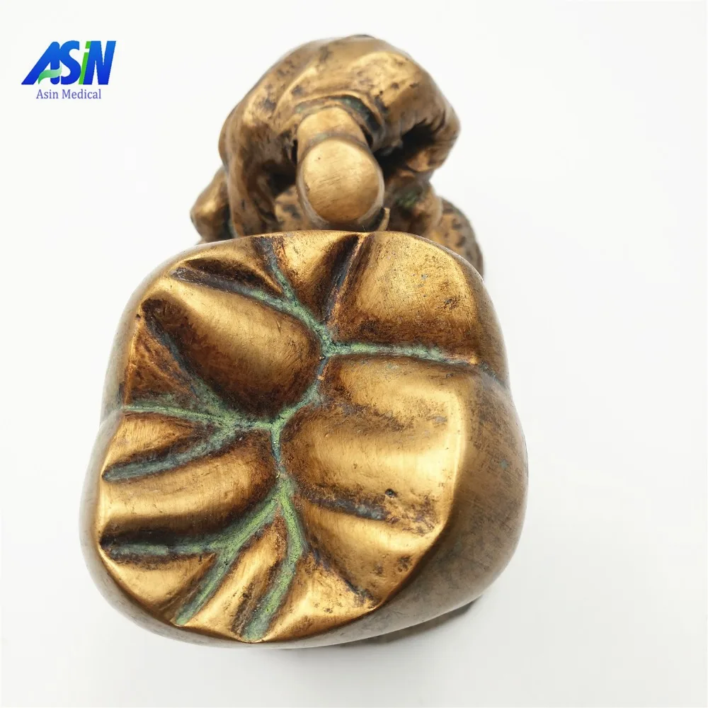 High Quality 2017 Dental model copper material Copper statue of man and