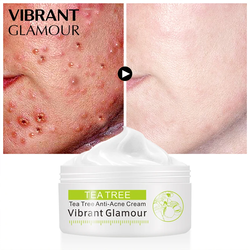 

Tea Tree Anti-Acne Face Cream Acne Scar Cream Shrink Pores Facial Eliminates Acnes Cream Oil Control Repair Spot