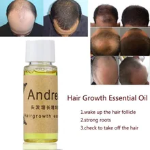 Andrea Hair Growth Жидкость против выпадения волос 20 мл натуральный экстракт с натуральным восстанавливанием волос быстро, гуще, Andrea Hair Growth Oi