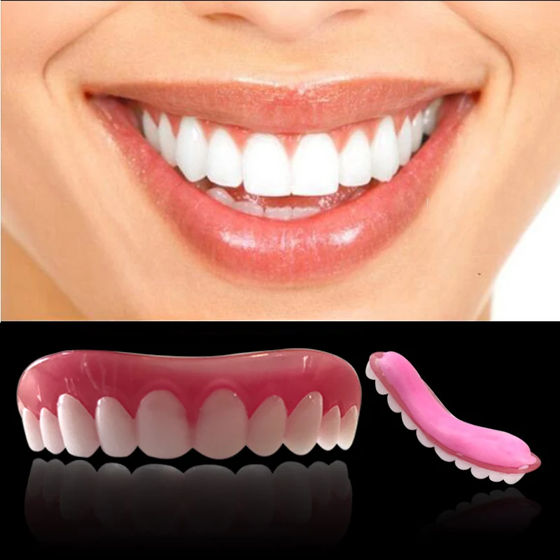 Накладки на зубы виниры цены фото Накладки на зубы виниры цены фото