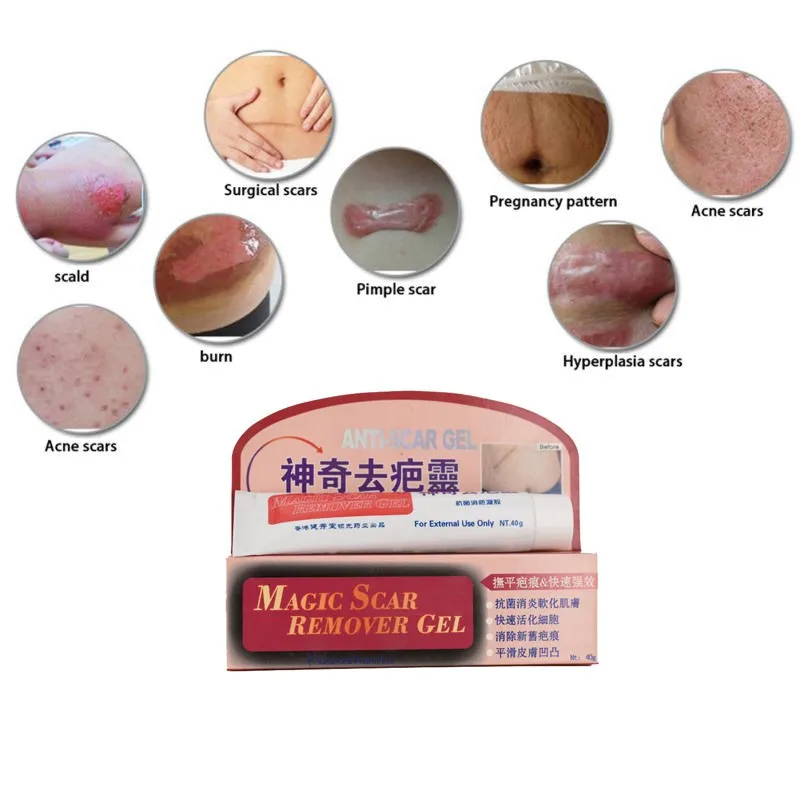 

40g Scar Remover Cream Skin Repair Acne Acne Treatment Blackhead Bleaching Cream