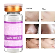 10 мл поры деликатная эссенция для удаления акне увлажнение и сужение пор подтягивающий лосьон Удаление угрей