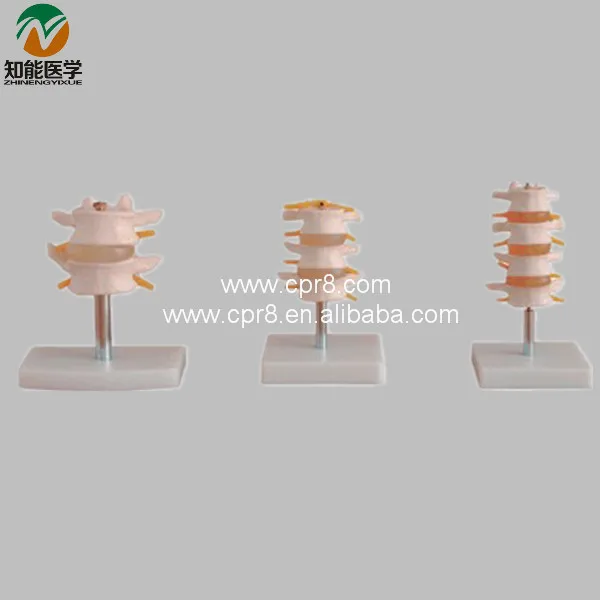

Normal Lumbar Set lumbar Vertebrae(2pcs 3pcs 4pcs) BIX-A1010 WBW272