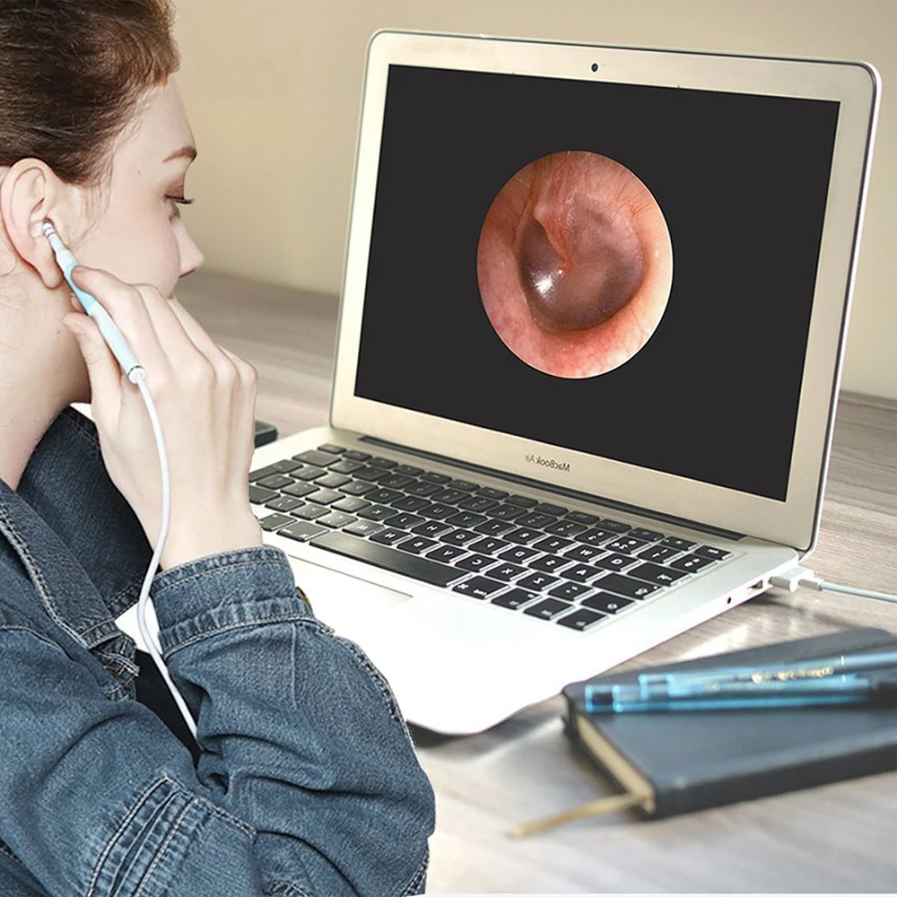 In-Ear-Cleaning-Endoscope-USB-Visual-Ear-Spoon-5-5mm-0-3MP-Mini-Camera-Android-PC (1)