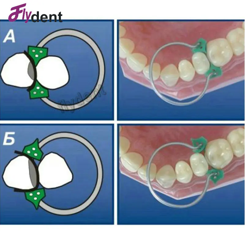 dental matrices  (5)