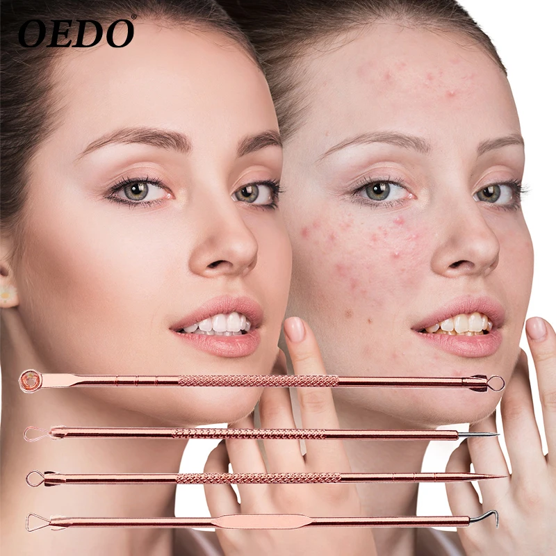 Rose Gold Acne Removal Needle From Acne Pimples Pimple Blackhead And