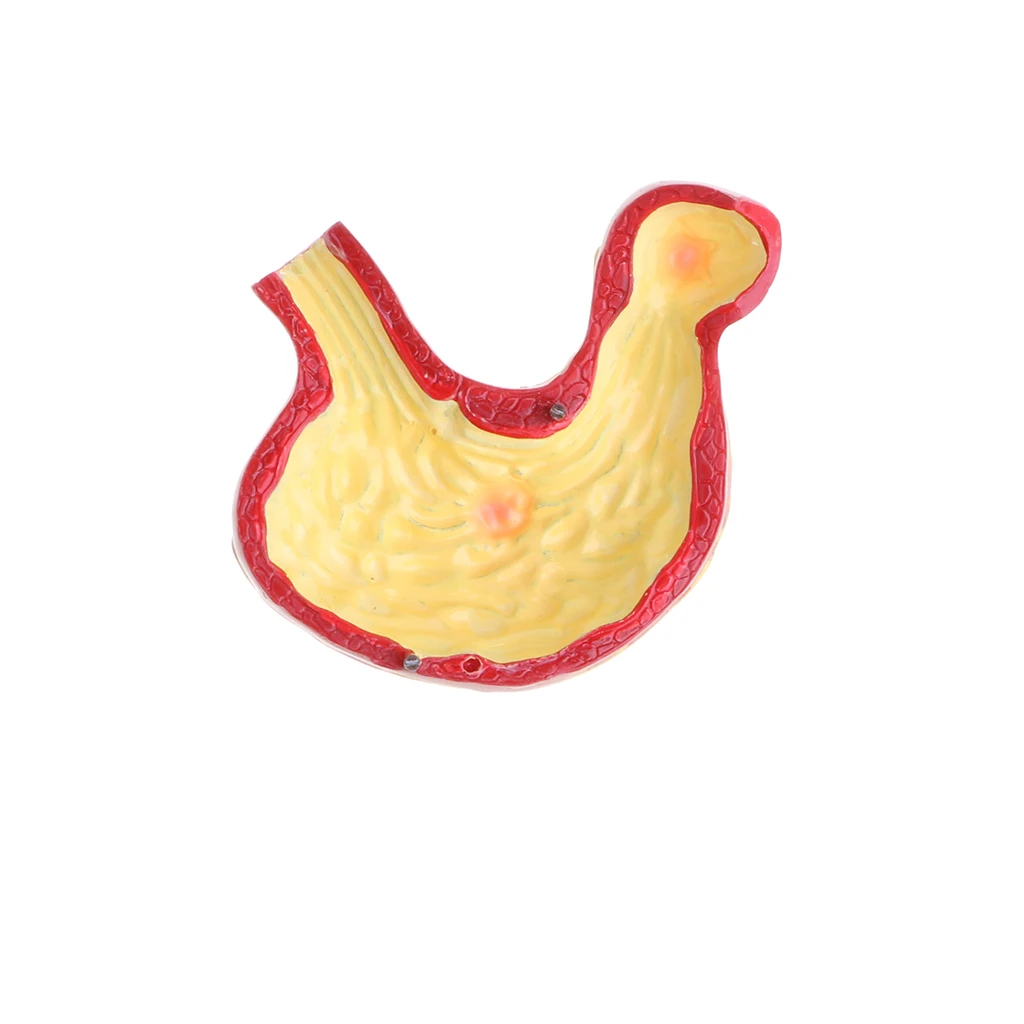 Minify 1X Human Large Intestine Stomach Pathological Model Medical Teaching Lab Demonstration Supplies