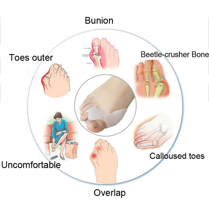 1Pair Bone Thumb Straightener Toes Separator Hallux Valgus Bunion Corrector Foot Care Tool for Pedicure Valgus Correction Device