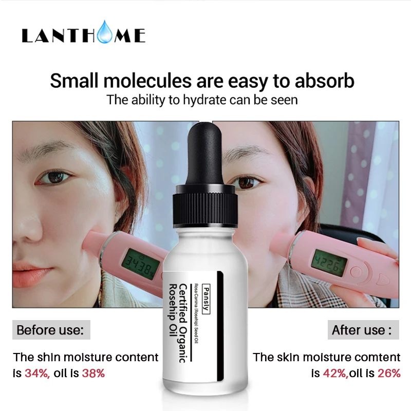 Harga Murni Organik Rosehip Minyak Whitening Pelembab Anti Aging Rose Hip Oil Minyak Perawatan Kulit Acne Scar Serum Stretch Mark remover