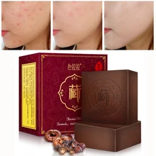 Face Body Wash Soap Pimple Pores Blackhead Removal Treatment Oil Control Moisturizing 100g