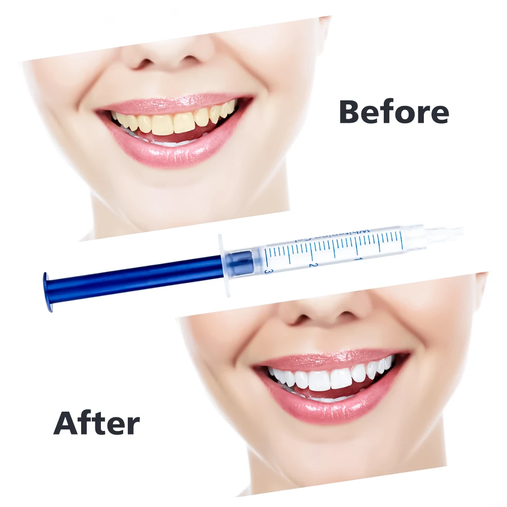 Отбеливающий для полости рта доттер для гель-лака наборы пероксид Профессиональный отбеливатель стоматологический гигиенический уход инструменты отбеливатель зубов светодиодный свет