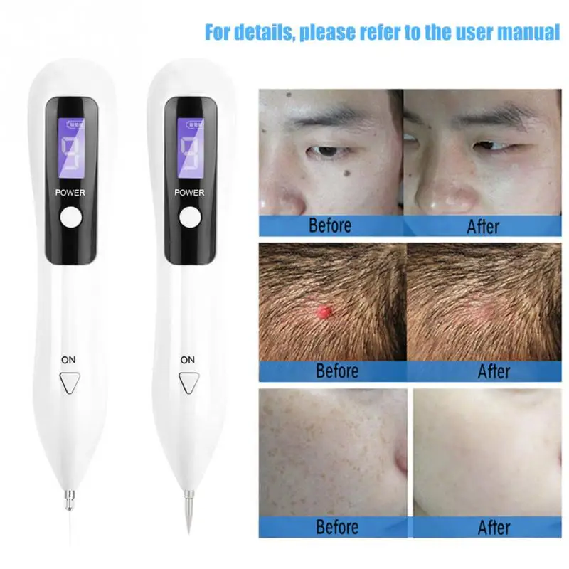 

9 level LCD Face Skin Dark Spot Remover Mole Tattoo Removal Laser Plasma Pen Machine Facial Freckle Tag Wart Removal Beauty Care