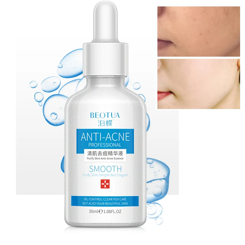 

Acne Treatment Serum Essence Moisturizing Anti Wrinkle Anti-allergy Face Intensive Face Lifting Deep Firming Nourishing Gel