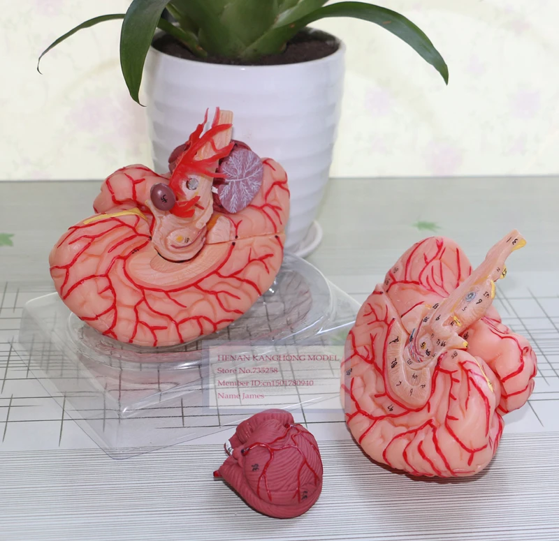 ISO Certification Cerebral Artery Dissection Model,Brain Model,Human Brain Anatomical Model ISO Certification Cerebral Artery Dissection Model,Brain Model,Human Brain Anatomical Model
