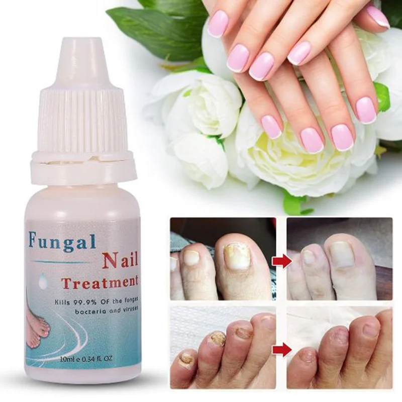 

10ML Nail Polish Onychomycosis Nail Repair Moisturizing Liquid Nourishing Liquid Armor Sterilization Nail Treatment TSLM1