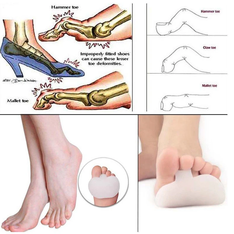 Уход за ногами Чистый гель метатарзальный коврик больной мяч для ног Подушечка Для Снятия Боли стельки для передней части стопы поддержка 1 пара = 2 штуки