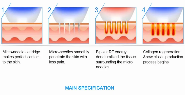 Технология фракционный RF микроиглы машина для удаления шрамов лечение акне удаление растяжек омоложение кожи микрон