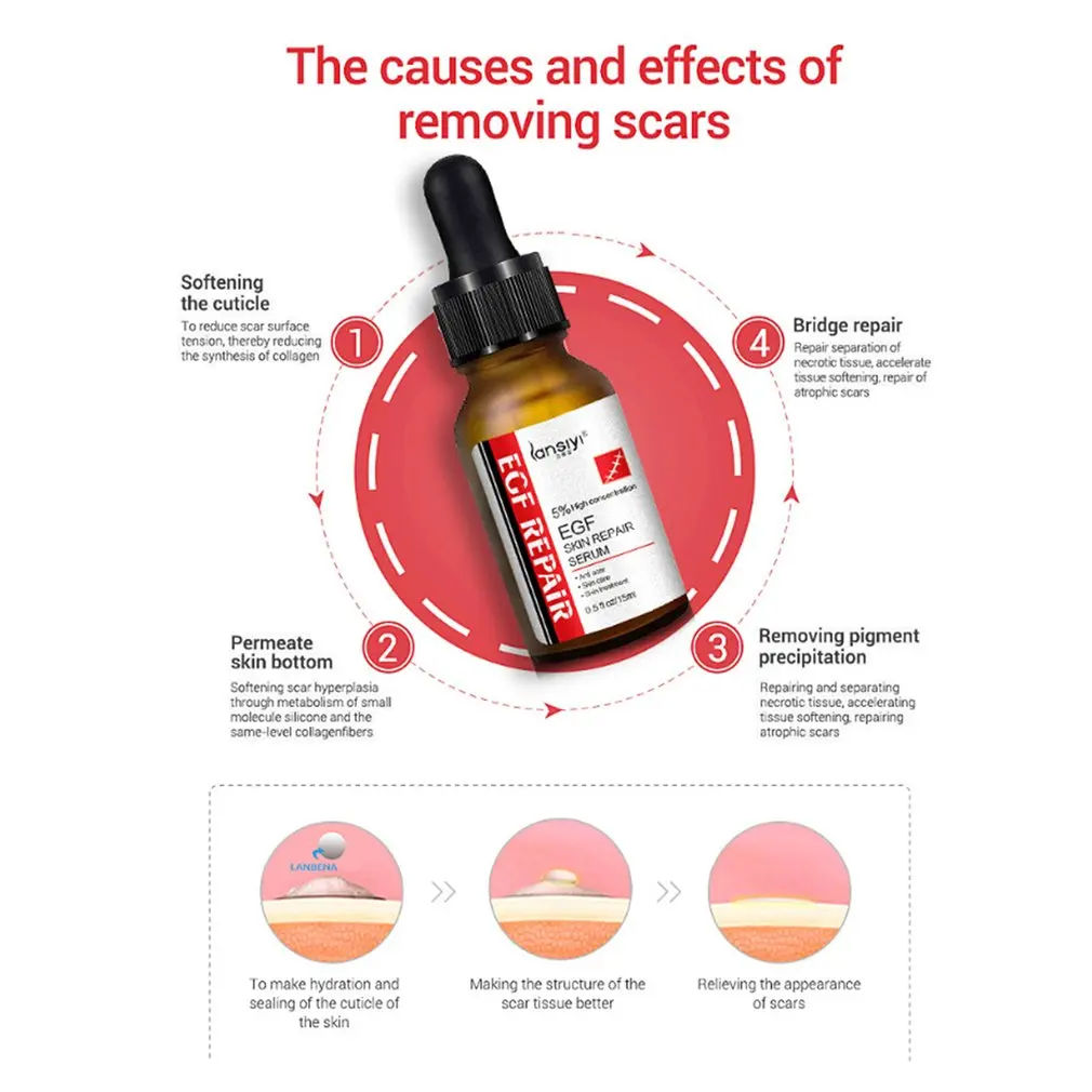 Уход за кожей лица EGF сублимированный порошок олигопептид раствор ремонт шрам акне напечатанный красно-кровяной акне эссенция сужает поры