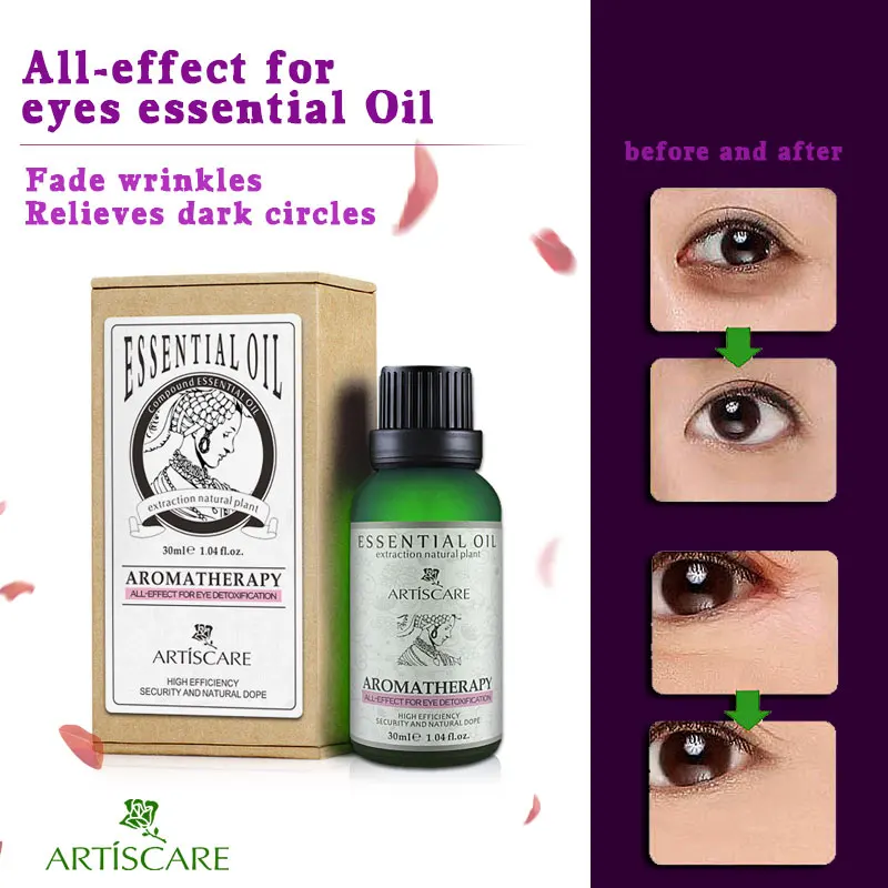 ARITISCARE Beauty Eye Essential Oil 30ml For Dark Circles Under Eyes Anti Wrinkles Anti Aging
