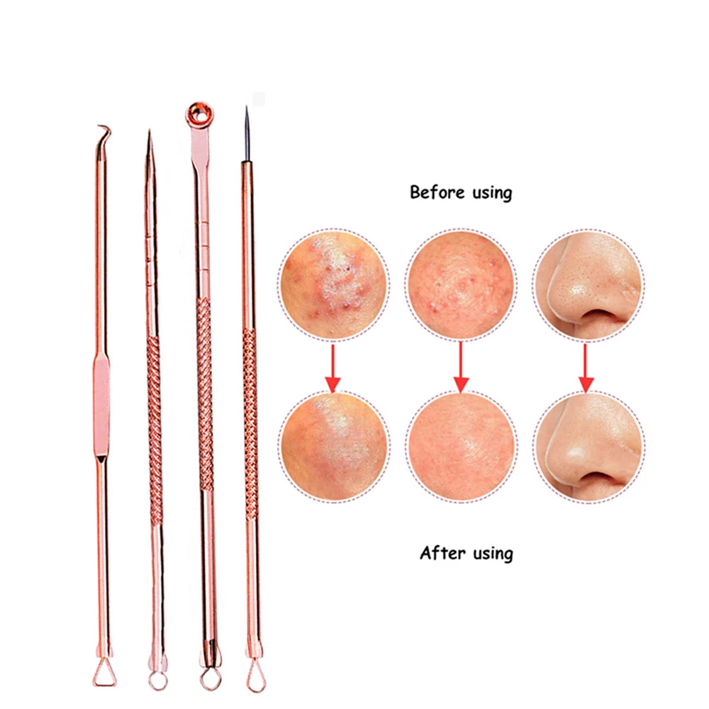 4 pcs/Set Skin Care Beauty Products Acne Blackhead Removal Needles
