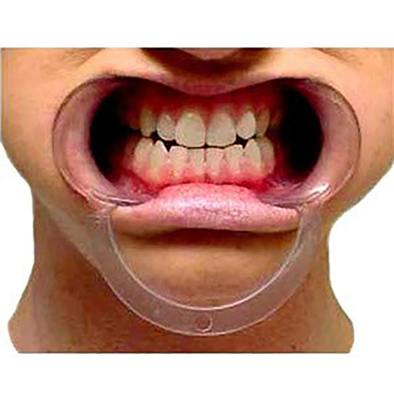 20 pièces écarteur de joue jetable lèvre transparente en forme de C blanchissant les dents ouvre-bouche 透明中号