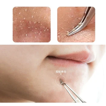 

Straight Bend Curved Blackhead Acne Clip Tweezer Pimple Comedone Remover Kit Face Cleaner