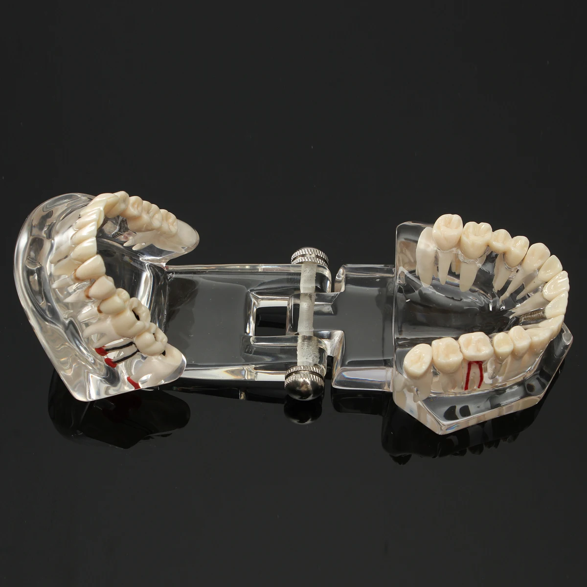 Implant Model zębów dentystycznych z przywracaniem mostek dentystyczny dla nauk medycznych narzędzie do nauki chorób stomatologicznych 3 Implant Model zębów dentystycznych z przywracaniem mostek dentystyczny dla nauk medycznych narzędzie do nauki chorób stomatologicznych 3
