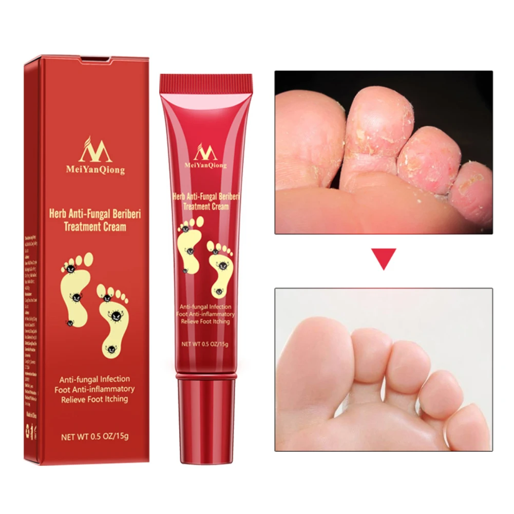 

MeiYanQiong 15g Foot Repair Anti Crack Whitening Cream Foot Peeling Cracked Hands Feet Dry Skin Moisturizing Care TSLM2
