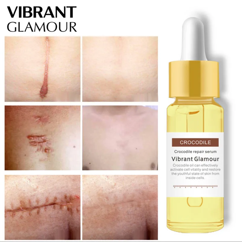 VIBRANT GLAMOUR Skin Repair Cream Crocodile Dispel Scar Facial Repair