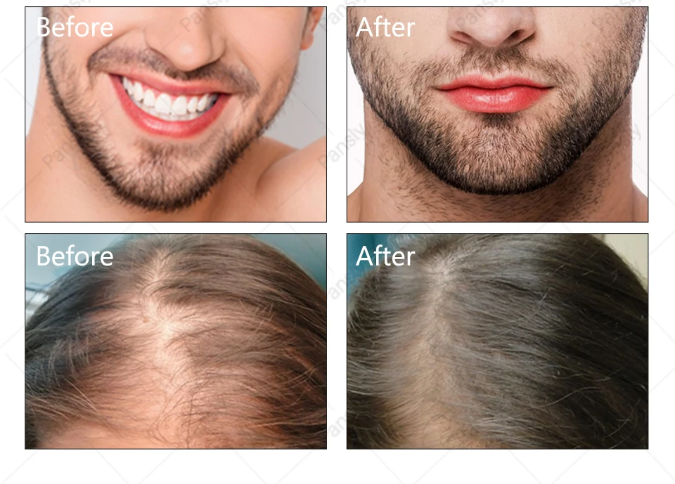 Фото где МАСЛО УСЬМЫ ФОТО ДО И ПОСЛЕ