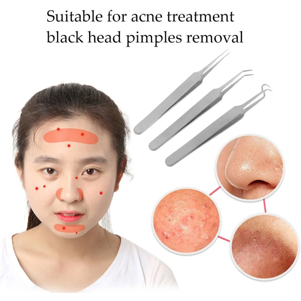 Acne Tweezers Blackhead Pimples Removal Pointed Bend Gib Face Skin Care