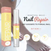 4 мл лечение инфекции ногтей ручка питательный раствор удаляет Onychomycosis Paronychia анти грибковые Ноги Уход биологический ремонт