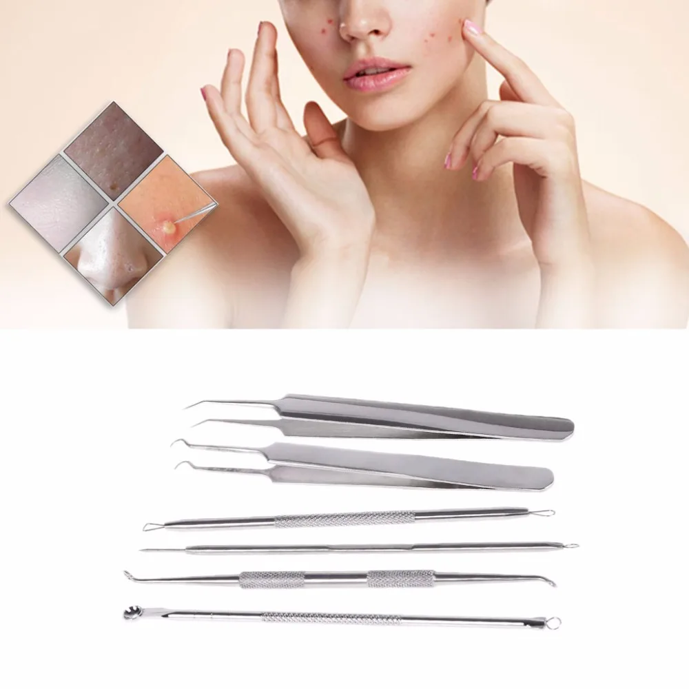 6 Pcs Blackhead Acne Removal Extractor Blemish Pimple Spot Facial