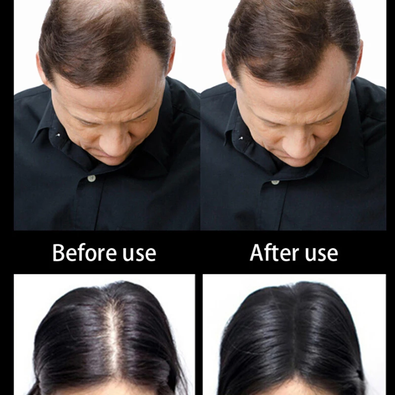 Кератиновые Волокна Для Волос Купить